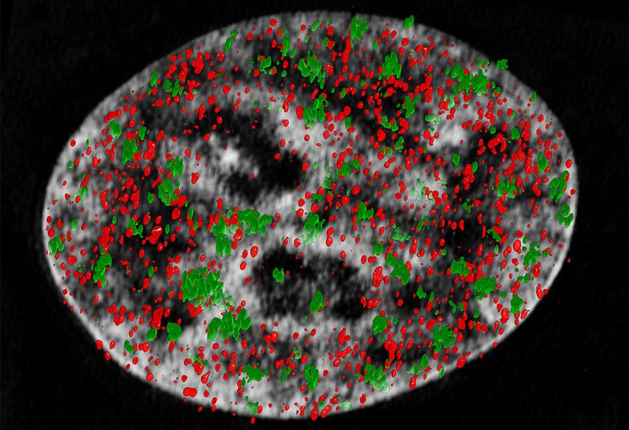 Nano-Blick auf die DNA-Reparatur Nano-Blick auf die DNA-Reparatur