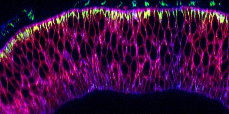 Nanobodies in der Flügelanlage einer Fruchtfliegen-Larve Nanobodies in der Flügelanlage einer Fruchtfliegen-Larve