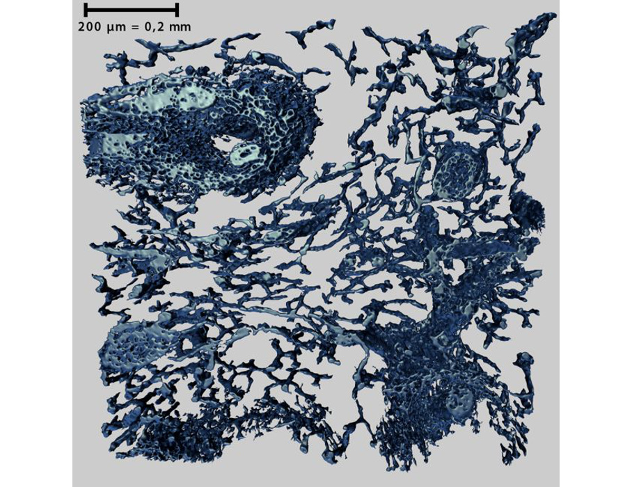 3D-Bilder vom Netzwerk kleinster Blutgefäße
