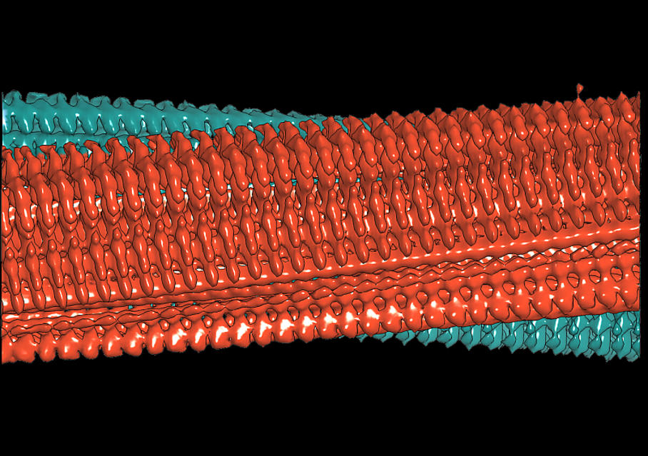 Amyloid-Fibrille Amyloid-Fibrille