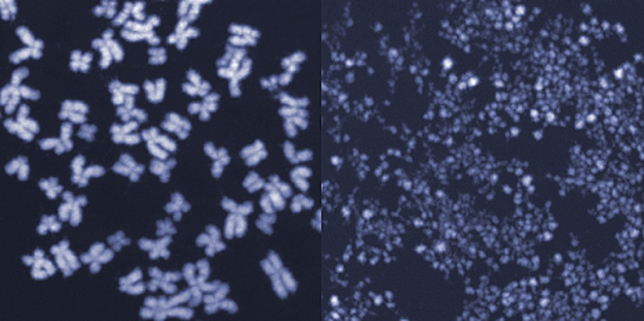 Chromosomen Chromosomen