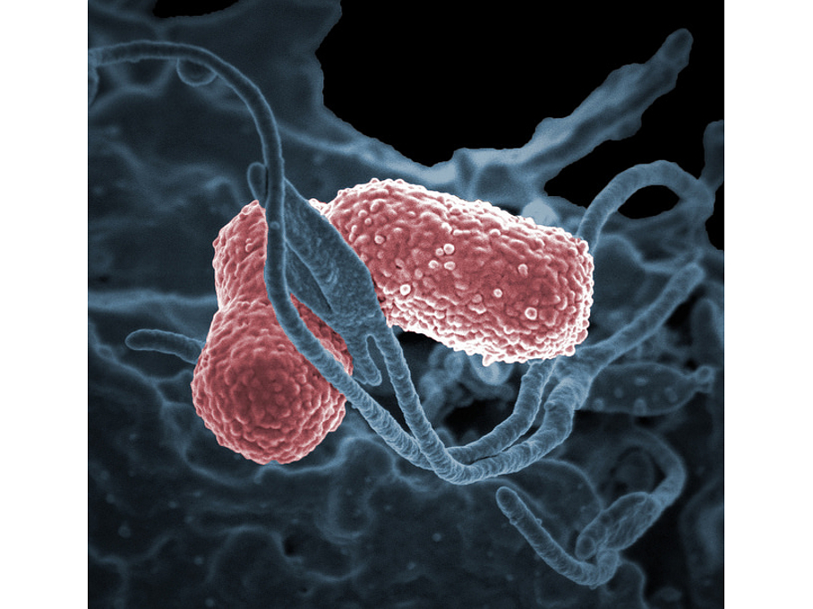 Klebsiella pneumoniae