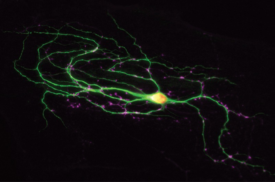 Fluoreszierende Nervenzelle Fluoreszierende Nervenzelle