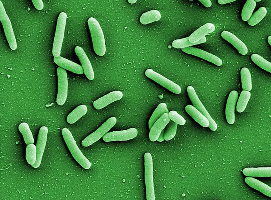 Krankheitserreger Pseudomonas aeruginosa Krankheitserreger Pseudomonas aeruginosa