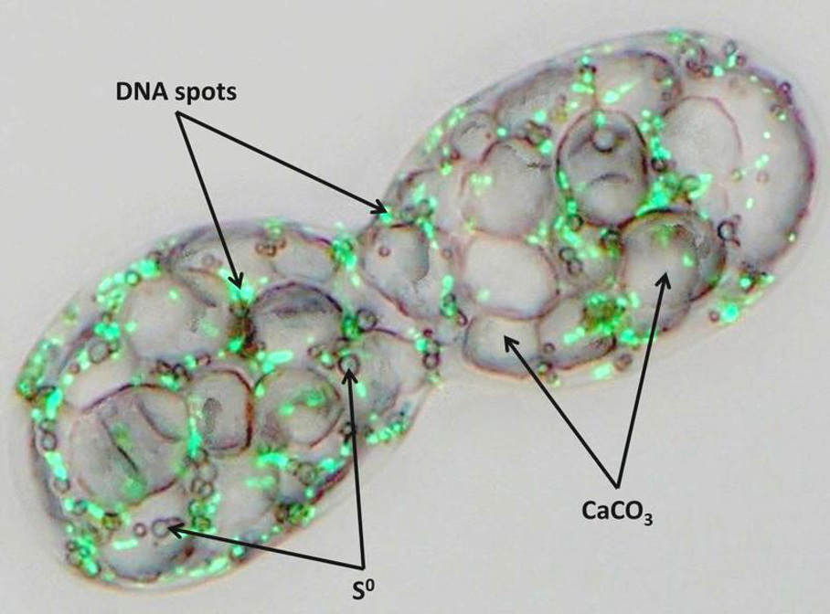 Achromatium oxaliferum Achromatium oxaliferum