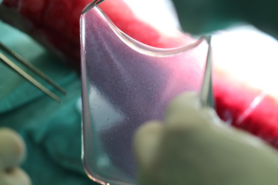 Fibrinsheet mit den darauf befindlichen genetisch modifizierten Stammzellen Fibrinsheet mit den darauf befindlichen genetisch modifizierten Stammzellen