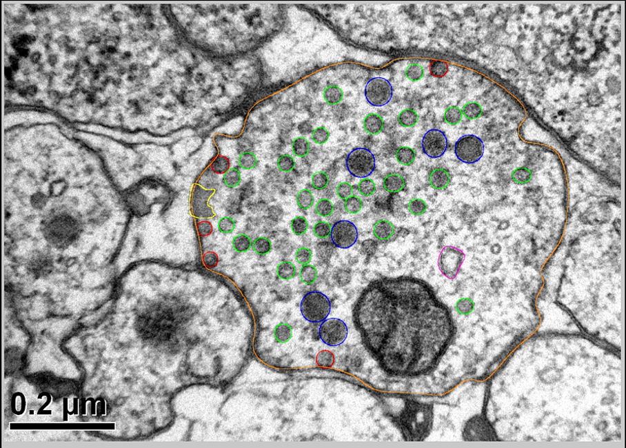 Dünnschnitt durch die Synapse eines Motorneurons des Fadenwurms Caenorhabditis elegans Dünnschnitt durch die Synapse eines Motorneurons des Fadenwurms Caenorhabditis elegans
