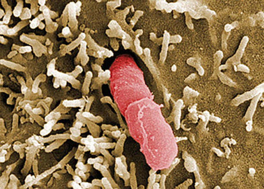 Yersinia_pseudotuberculosis