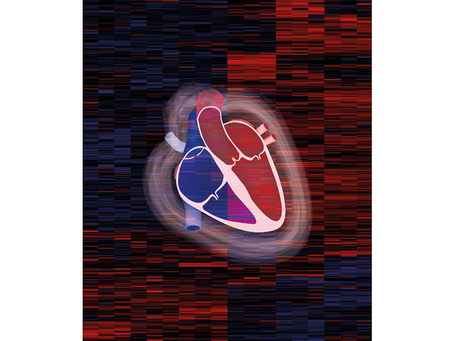 Herzschemata mit Heatmap Herzschemata mit Heatmap